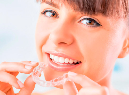 Aparelho Invisalign - Moema - SP