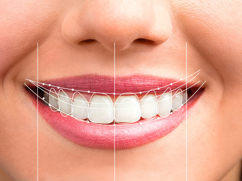 dsd digital smile design dahdal aoun odontologia moema sp