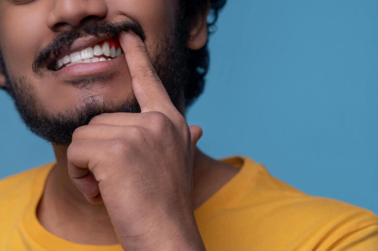 Gengiva Sangrando ao Escovar os Dentes? Entenda o Que Fazer