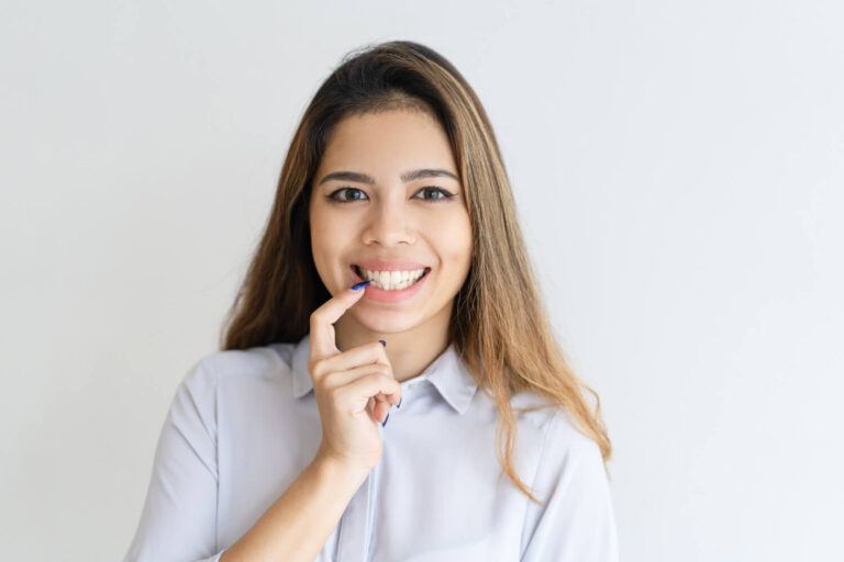 Mulher sorridente aponta para dentes brancos após clareamento dental em Moema na Dahdal Aoun, demonstrando satisfação com o resultado.