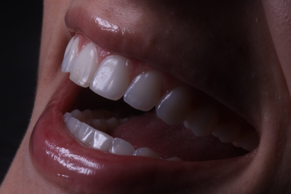 ESTÉTICA dental dahdal aoun (1)