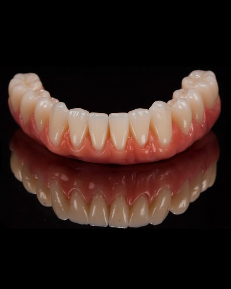 Implantes Dentários e Prótese Protocolo dahdal aoun odontologia