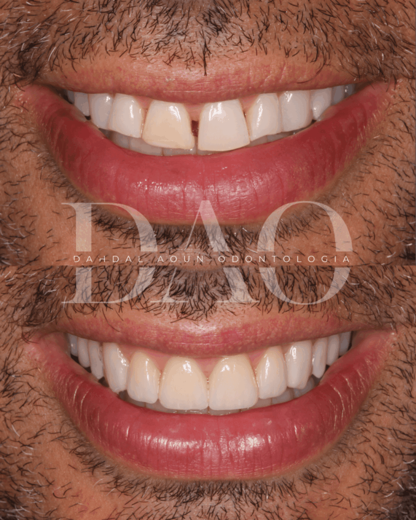 ODONTOLOGIA ESTÉTICA