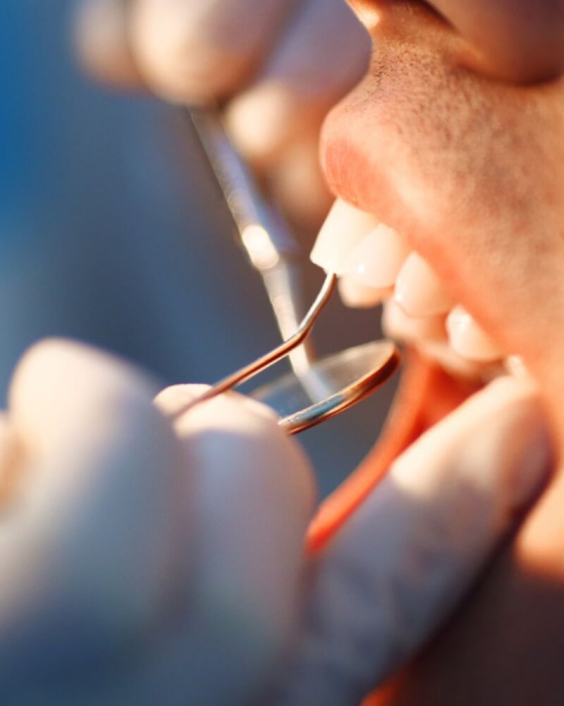 Programa de Prevenção dentista em moema