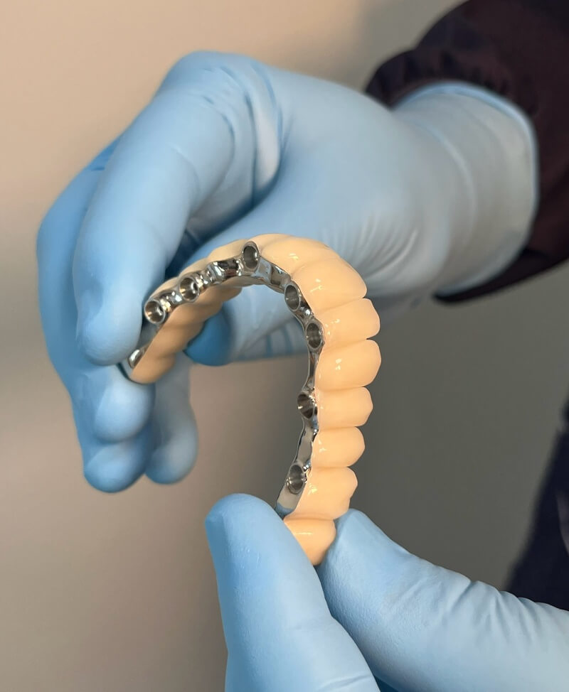 Prótese Dentária em Moema Dahdal Aoun Odontologia